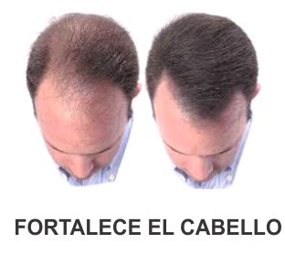 FORTALECE EL CABELLO