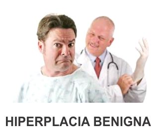 HIPERPLACIA BENIGNA