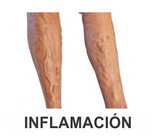 INFLAMACION