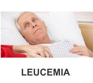 LEUCEMIA