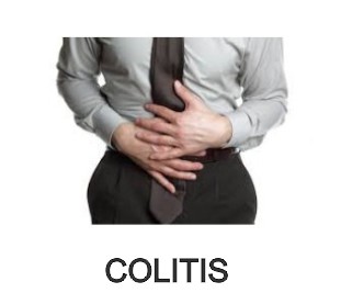 cancer de colon fibramor colitis fibram colitis nerviosa ulcer1