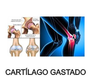 cartilago gastado artiplus