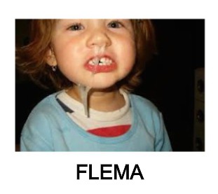 flema moco flema garganta elixir de moringa